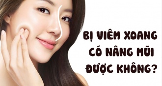 Tư vấn chuyên gia: bị viêm xoang có nâng mũi được không?